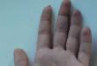 Дефекты, которые уродуют голливудских звезд (14 фото) Некрасивая форма пальцев на руках у девушек