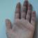 Дефекты, которые уродуют голливудских звезд (14 фото) Некрасивая форма пальцев на руках у девушек